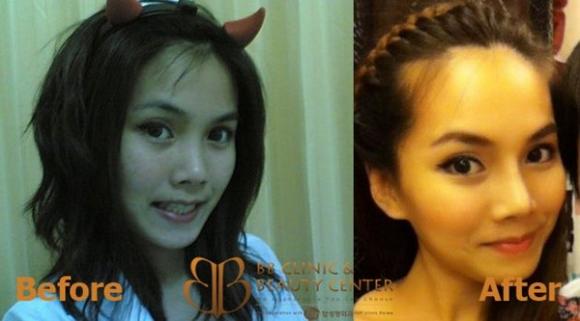 phẫu thuật thẩm mĩ,thái lan,cô gái,phụ nữ,xinh đẹp