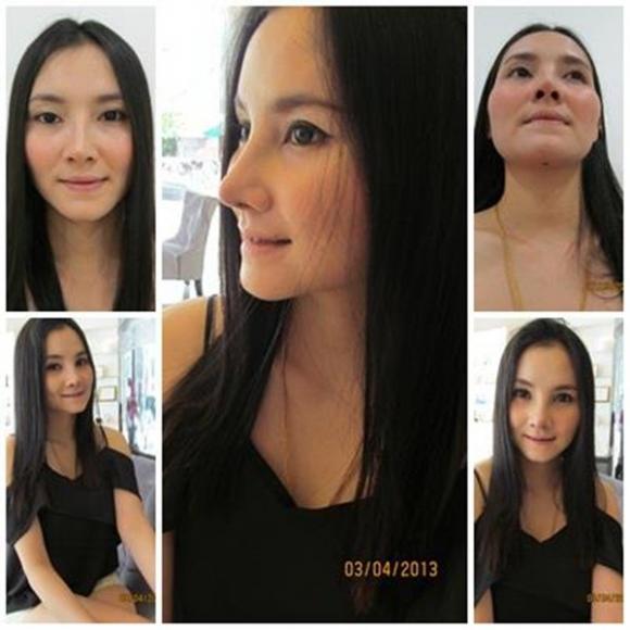 phẫu thuật thẩm mĩ,thái lan,cô gái,phụ nữ,xinh đẹp