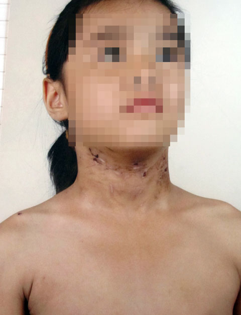 Bạo hành,cha mẹ bạo hành,những vụ cha mẹ bạo hành con chấn động Việt Nam