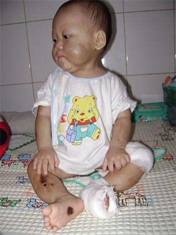 Bạo hành,cha mẹ bạo hành,những vụ cha mẹ bạo hành con chấn động Việt Nam