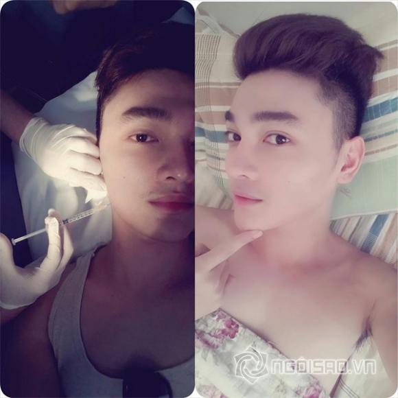 hot boy của phi thanh vân,Anthony Trần,Anthony Trần thẩm mỹ,Anthony Trần thời đen nhẻm,sao việt,sao thẩm mỹ,gà cưng của phi thanh vân