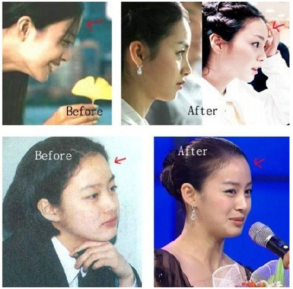 Kim Tae Hee,Kim Tae Hee phẫu thuật,sao Hàn,thánh nữ đa tài của màn ảnh Hàn