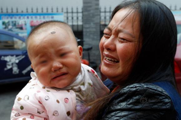 Cây kim,em bé mọc kim,em bé mọc kim khắp người tại Trung Quốc