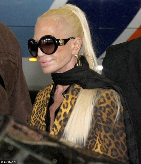Donatella Versace dao kéo,Donatella Versace thảm họa thẩm mỹ,thảm họa thẩm mỹ của Hollywood,gương mặt Donatella Versace biến dạng
