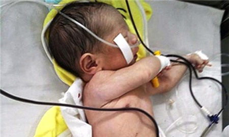 Thai nhi, vụ tai nạn khiến thai nhi văng khỏi bụng mẹ,nỗi đau phía sau vụ tai nạn khiến thai nhi văng khỏi bụng mẹ