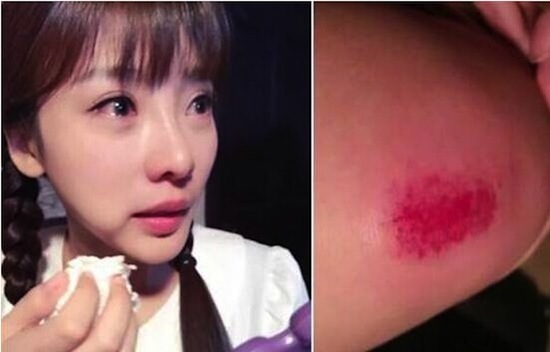 Liễu Nham, Liễu Nham đóng phim, Liễu Nham ngã, Liễu Nham ngã sưng mặt 