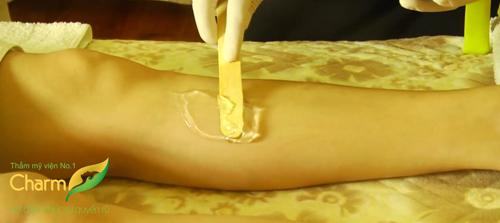 Triệt lông vĩnh viễn, Thẩm mỹ viện uy tín, Thẩm Mỹ công nghệ cao Charm