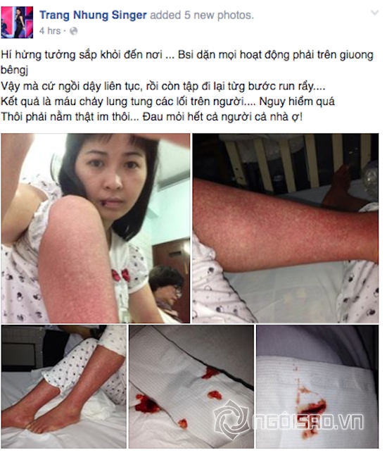 Trang Nhung ca sĩ, ca sĩ Trang Nhung bị bệnh, ca sĩ Trang Nhung bị sốt xuất huyết, sao bị bệnh 