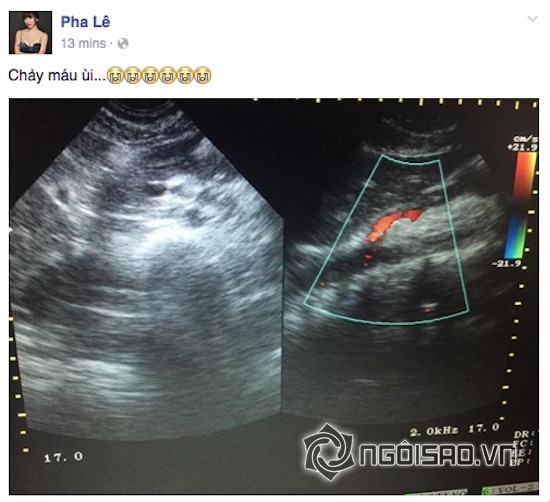 sao Việt đổ bệnh, Hồ Ngọc Hà, Mai Phương Thuý, Lý Nhã Kỳ, Pha Lê 