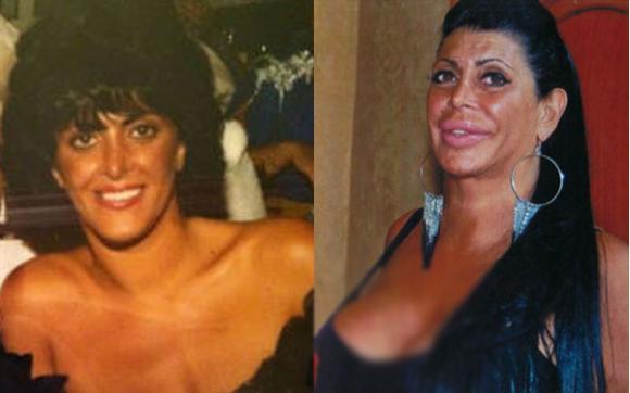 Sao truyền hình Mỹ, Angela Raiola, Big Ang, dao kéo quá đà