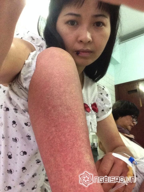 sao Việt đổ bệnh, Hồ Ngọc Hà, Mai Phương Thuý, Lý Nhã Kỳ, Pha Lê 
