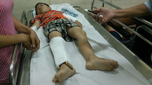 Bạo hành,bạo hành trẻ em,người thân bạo hành trẻ