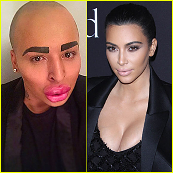 Kim Kardashian,phẫu thuật giống Kim,nam thanh niên xấu xí,ngôi sao truyền hình thực tế,Kim siêu vòng ba
