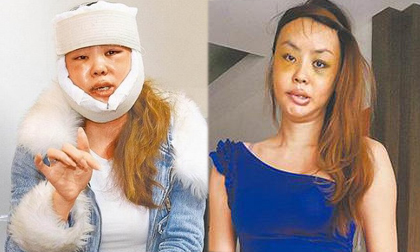 nữ diễn viên Đài Loan,Tạ Hân Dư,Tạ Hân Dư bị nhà chồng đánh đập,Tạ Hân Dư bị nhà chồng quấy rối
