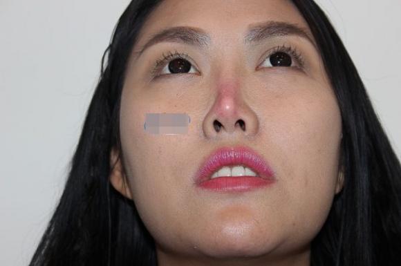 Phi Thanh Vân,diễn viên Phi Thanh Vân,Phi Thanh Vân biến dạng,hậu quả dao kéo của Phi Thanh Vân