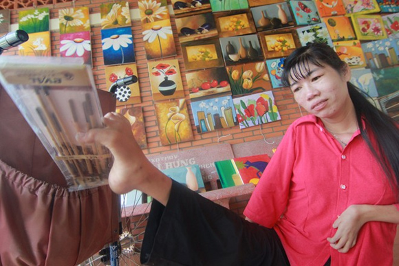 Cuộc sống của những con người khuyết tật