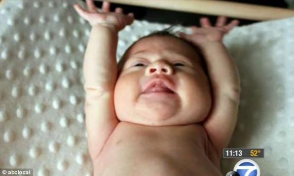 em bé ma,em bé sinh ra không có máu trong người