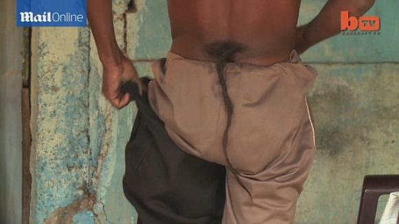 Ấn Độ,Anh Chandre Oraon ở Ấn Độ,đàn ông đuôi dài 36cm