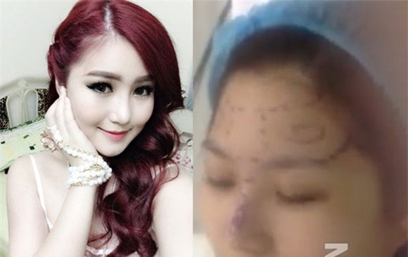 Sao,sao Việt,những kiểu phẫu thuật phẩm mỹ,Hương Tràm,Hồ Quỳnh Hương.