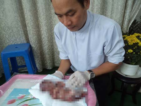 Chôn cất thai nhi,Linh mục,Nghĩa trang hài nhi,Phá thai