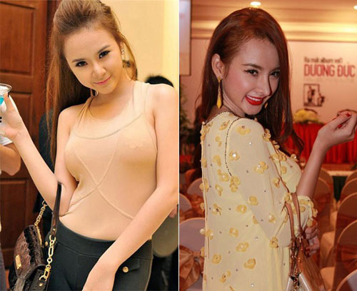 Sao,sao Việt,thẩm mỹ,Hương tràm,Angela Phương Trình