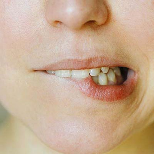 Thói quen có hại,Nhai kẹo cao su,Nghiến răng,Cắn móng tay
