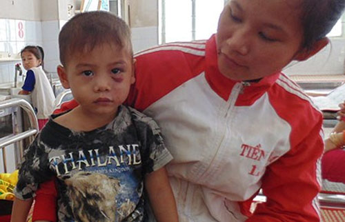Bạo hành trẻ em,Đánh đập trẻ em,Cha dượng đánh con riêng của vợ