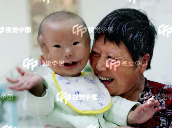 Chuyện lạ khuôn mặt,cậu bé,miệng rộng,mang tai,Trung Quốc.