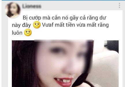 Cô gái,cắn tên cướp,gãy răng,khoe ảnh Zalo,cộng đồng mạng