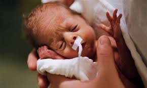 trẻ sinh non,nghiên cứu về trẻ sinh non