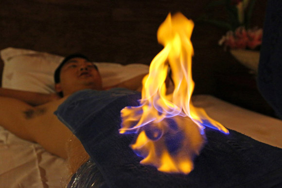 Đốt lửa trên người,chuyện lạ đốt lửa trên người chữa bệnh,chữa bệnh kỳ lạ