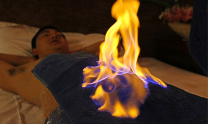 đốt lửa trên người, bỏng vì đốt lửa trên người, fire challenge