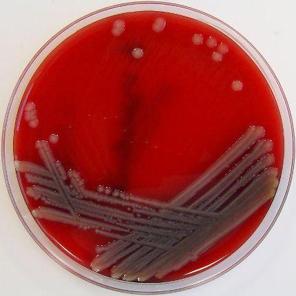 Vi khuẩn ăn thịt người,Vi khuẩn Aeromonas hydrophila,Cắt tay chân