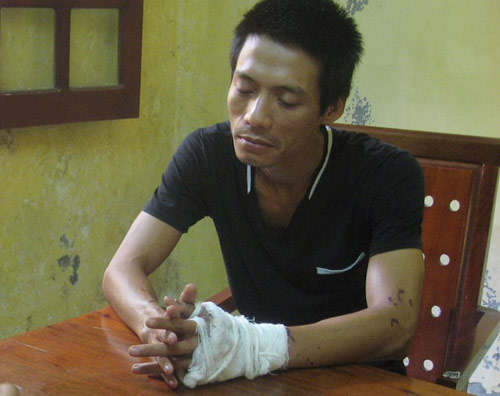 Tạt axit vợ,Đánh ghen,Đổ axit vào mặt vợ