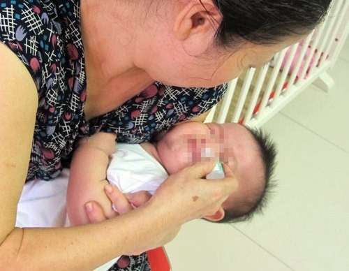 Ngộ độc thuốc nhỏ mũi,ngộ độc khi nhỏ mũi