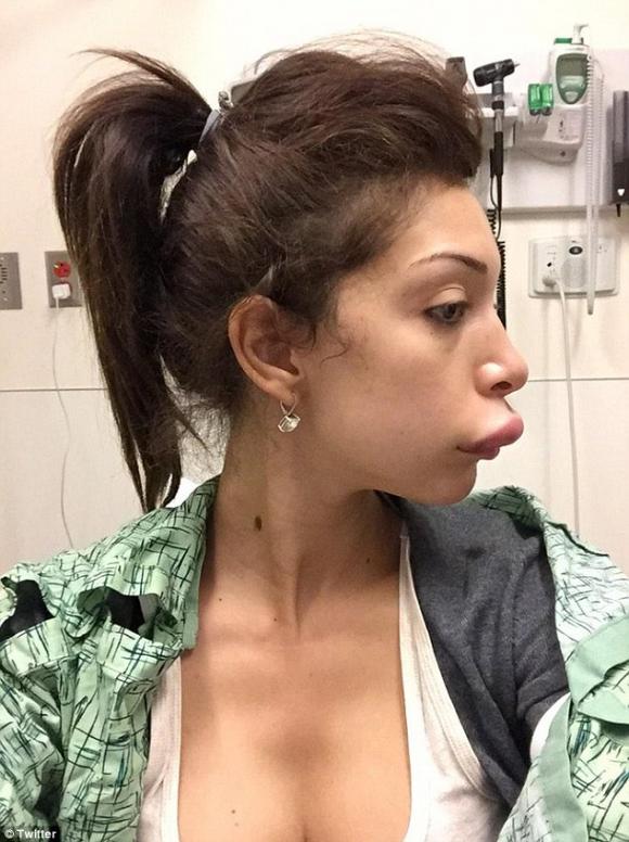 Sao tuổi teen,Farrah Abraham,sao Farrah Abraham,Farrah Abraham phẫu thuật thẩm mỹ