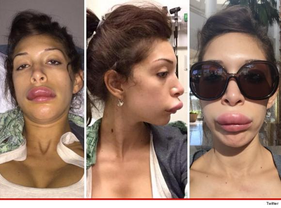 Sao tuổi teen,Farrah Abraham,sao Farrah Abraham,Farrah Abraham phẫu thuật thẩm mỹ