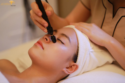 Adamas Spa, Trị mụn công nghệ cao, Hoàng Thùy Linh