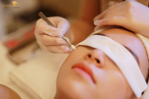 Adamas Spa, Trị mụn công nghệ cao, Hoàng Thùy Linh