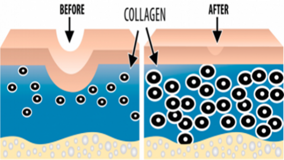 tốt cho tiêu hóa, tốt cho não bộ, collagen,  vitamin C