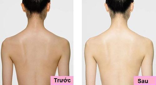 Tắm trắng, Da trắng sáng, Chăm sóc da, Solar spa