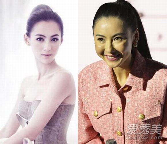 sao hoa ngu, my nhan hoa ngu, sao hoa ngu dao keo, sao hoa ngu phau that tham my, phẫu thuật thẩm mỹ