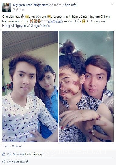 chuyện tình yêu, chuyện tình cảm động, chàng trai chung thủy, cô gái hủy hoại mặt, chuyện tình giới trẻ 
