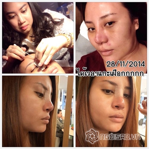 cô gái lột xác nhờ thẩm mỹ mũi, cô gái nổi tiếng trong giới trẻ Thái Lan