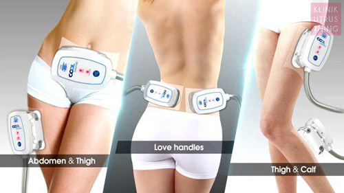 Solar Spa, Hủy mỡ 1 lần duy nhất, Hủy mỡ không phẫu thuật, Hủy mỡ công nghệ cao