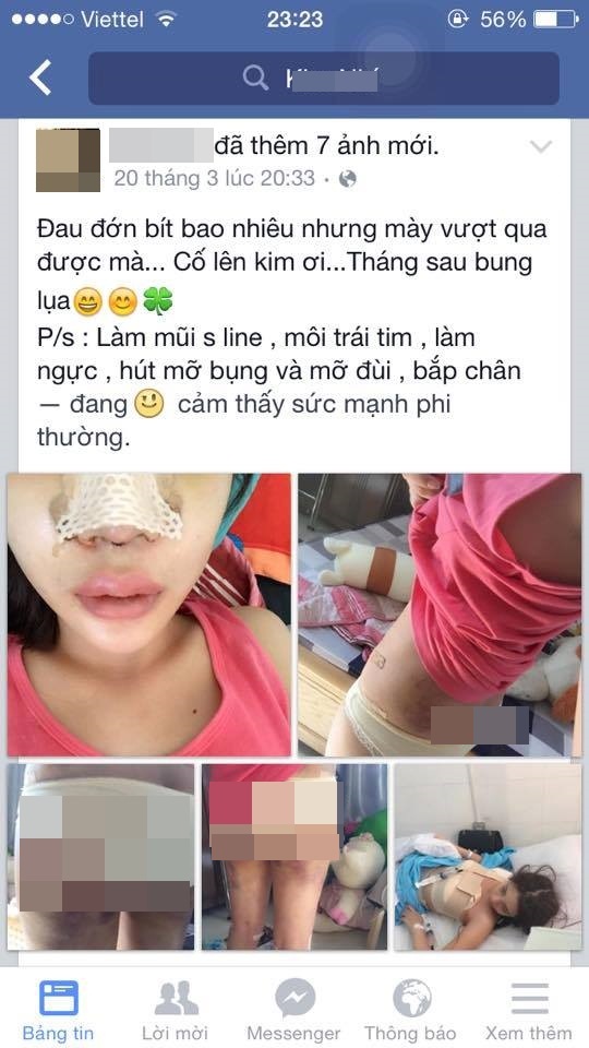 phau thuat tham my, co gai xinh dep, co gai Viet tham my, gioi tre tham my