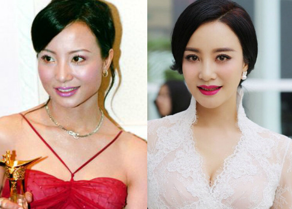 Đào Hồng, diễn viên Đài Hồng, Đào Hồng mặt cứng đờ, Đào Hồng thẩm mỹ