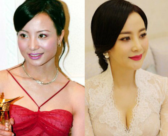 Đào Hồng, diễn viên Đài Hồng, Đào Hồng mặt cứng đờ, Đào Hồng thẩm mỹ