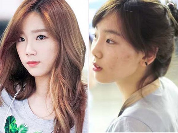 sao Hàn, mặt mộc sao Hàn, mặt mộc đầy mụn của sao Hàn, sao hàn mặt mụn, mụn, SNSD, Sunny, Tae Yeon, Sep Hyun, Dong Hae