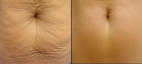 BB Beauté – BB Thanh Mai, Trẻ hóa da, Trẻ hóa da công nghệ cao